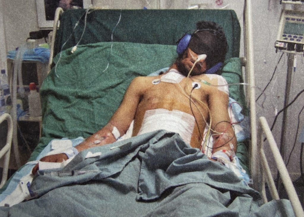 Taliban-patient. Høreværn og mørke briller er sat på, fordi patienten skal fragtes igennem hospitalet til røntgen. 